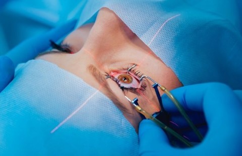 Lasik Surgery