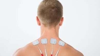 Spinal Cord Stimulation